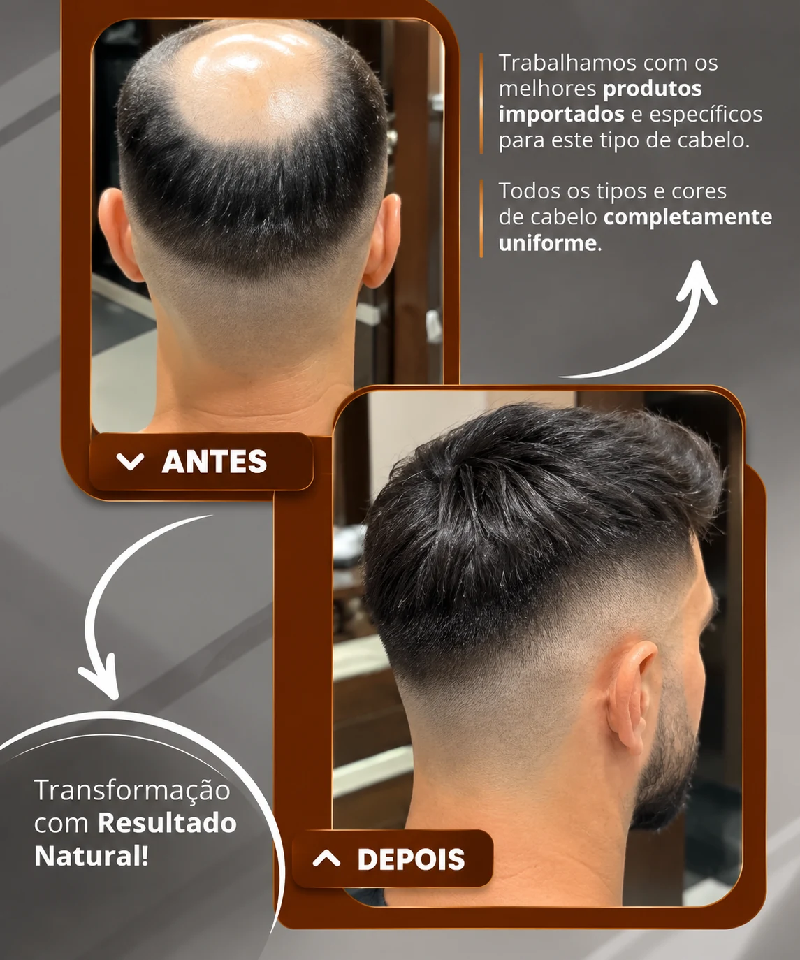 Antes e depois de transformação masculina com prótese capilar